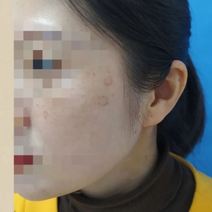 ���@��90��Ů��Ę�Ͼ��L�������