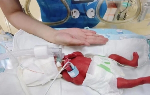 ���t�o�ˆT�cٝ����ꎳ���a�������Ժ��