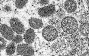 �ﶻ�Ѱl�����H������һ��Ҫ����x21��