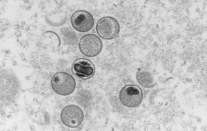 ȫ����������ͬ�r��Ⱦ�¹ںﶻ����