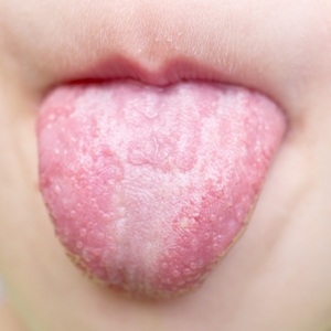 ����һ�ܣ��_ʼ���^�l�����X��ʧ