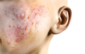 ��ȥ���ȥ���tԺ߀�������tԺ��