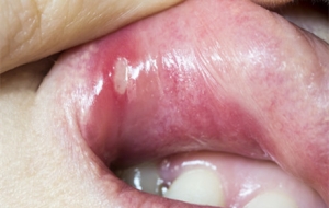 ������������һ������߀�]�ã��R�(zh��n)�Ђ��ˌ��T������ģ��Л]����֪����