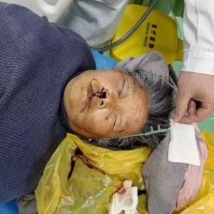 �o�����ˣ�һ���������tԺ���ȣ�