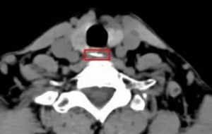 ��ꎳ��F(xi��n)1�����o�����ѡ�