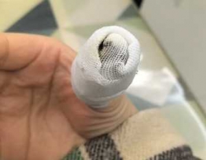 ��ꎹ���һ���e�Ӱ��Լ�Ū�M�tԺ��