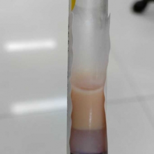 �����w�ȳ����ţ��Ѫ�������@Щ���T����Ҫע��