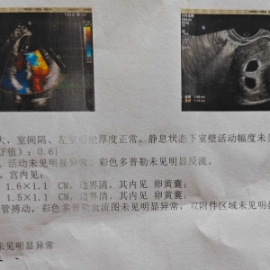 ��̥�����p��̥�����@��ϲ���B(y��ng)���������f(shu��)����(l��i)�o��ý㎧�������җl�����Ҽ�߀��